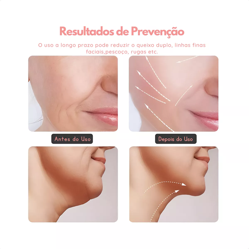 Aparelho de Renovação Facial com Fototerapia - Aparelho de Lifting facial